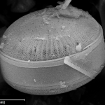 Diatomee-Mikrofossil (SE)